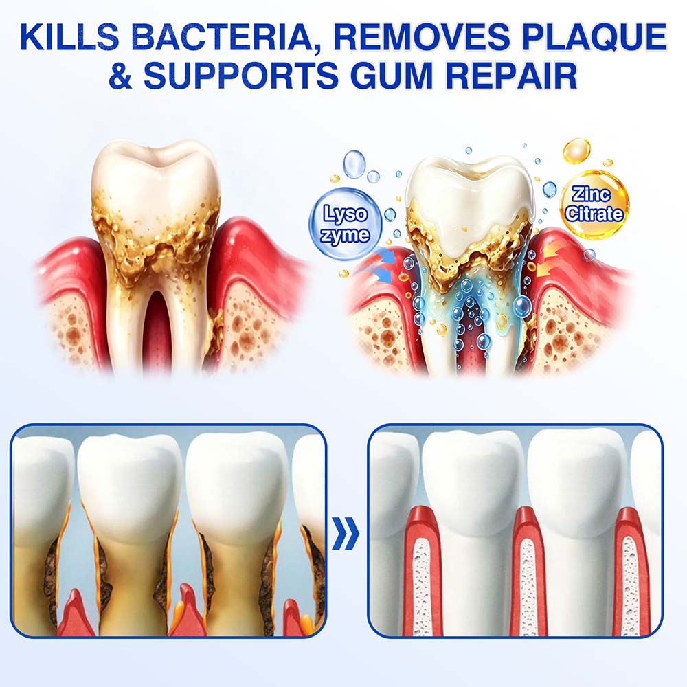 🦷𝐏𝐔𝐑𝐄𝐋𝐎𝐑𝐀® GumRevive Periodontal Repair Gel (for bleeding gums, receding gums, and loose teeth)