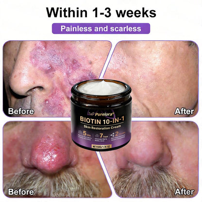 Made and Shipped from the UK 🍁 Purelora® Biotin 10-in-1 Skin Repair Cream — Last Day of Sale: 75% Off