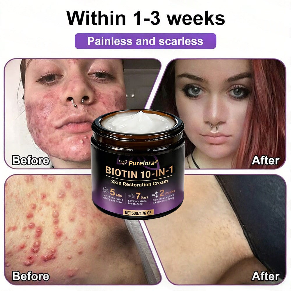 Made and Shipped from the UK 🍁 Purelora® Biotin 10-in-1 Skin Repair Cream — Last Day of Sale: 75% Off