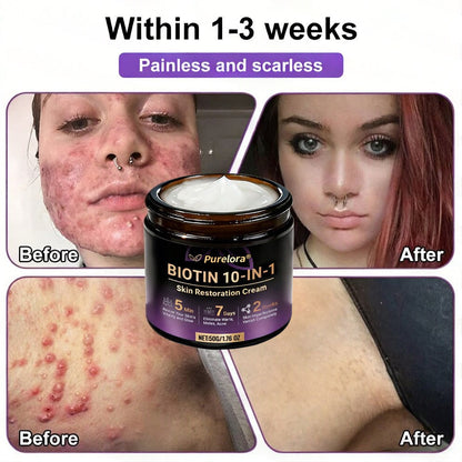 Made and Shipped from the UK 🍁 Purelora® Biotin 10-in-1 Skin Repair Cream — Last Day of Sale: 75% Off