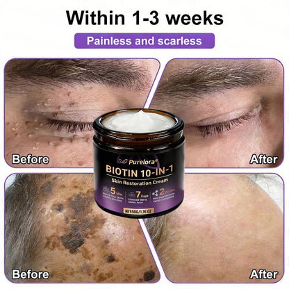 Made and Shipped from the UK 🍁 Purelora® Biotin 10-in-1 Skin Repair Cream — Last Day of Sale: 75% Off