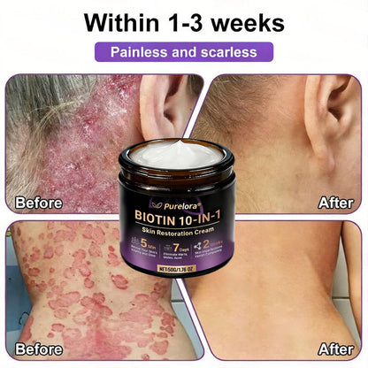 Made and Shipped from the UK 🍁 Purelora® Biotin 10-in-1 Skin Repair Cream — Last Day of Sale: 75% Off